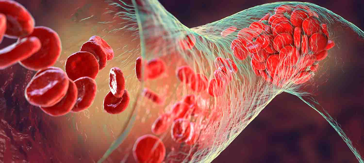 Blood vessel - hypertension controlled by contaminated generic valsartan