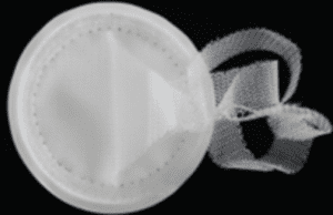 Ventralex Hernia Mesh