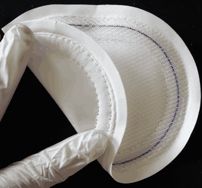 Broken Hernia Mesh Lawsuit