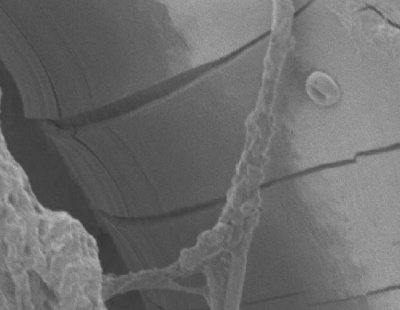 Degraded Polypropylene Hernia Mesh