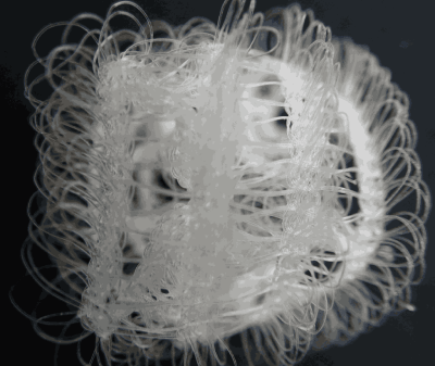 Hernia Mesh Plug Lawsuit