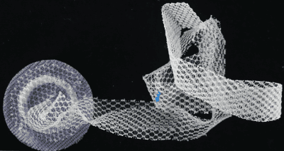 Resorbable Barrier Hernia Mesh Lawsuit